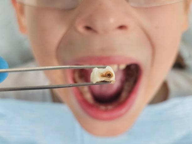 Best Same-Day Emergency Dental Services in Owings, MD